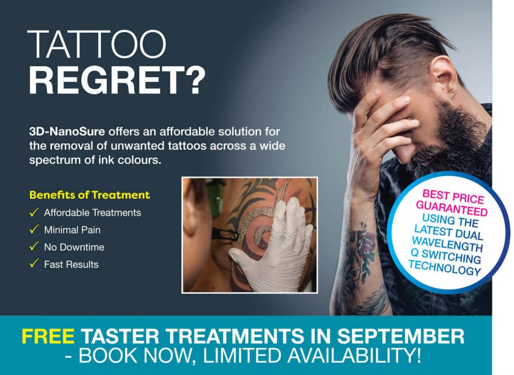 Laser Tattoo Removal