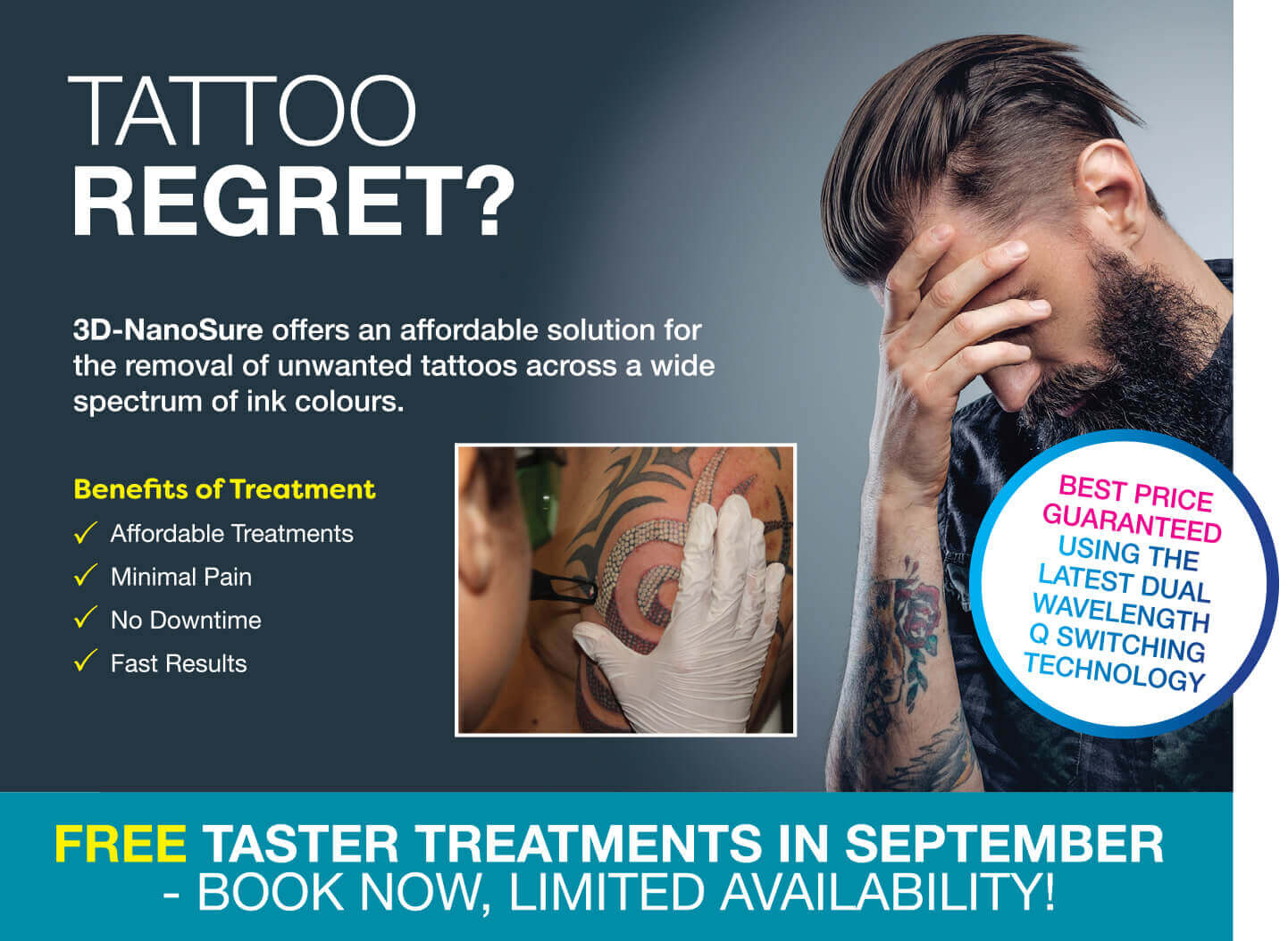 Tattoo Regret - 3D Lipo Leamington