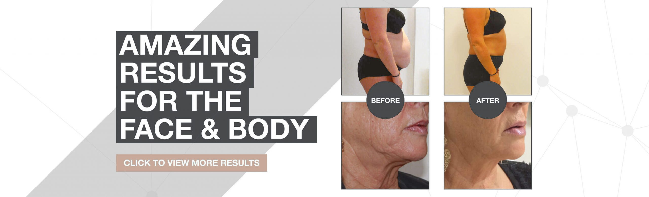 3d lipo leamington