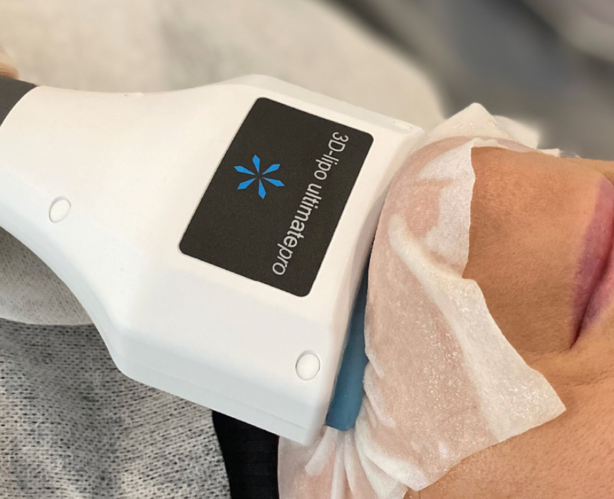 Double chin fat freezing treatment
