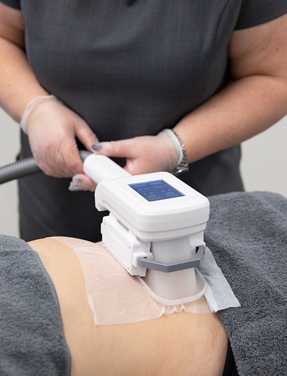 Fat Freezing