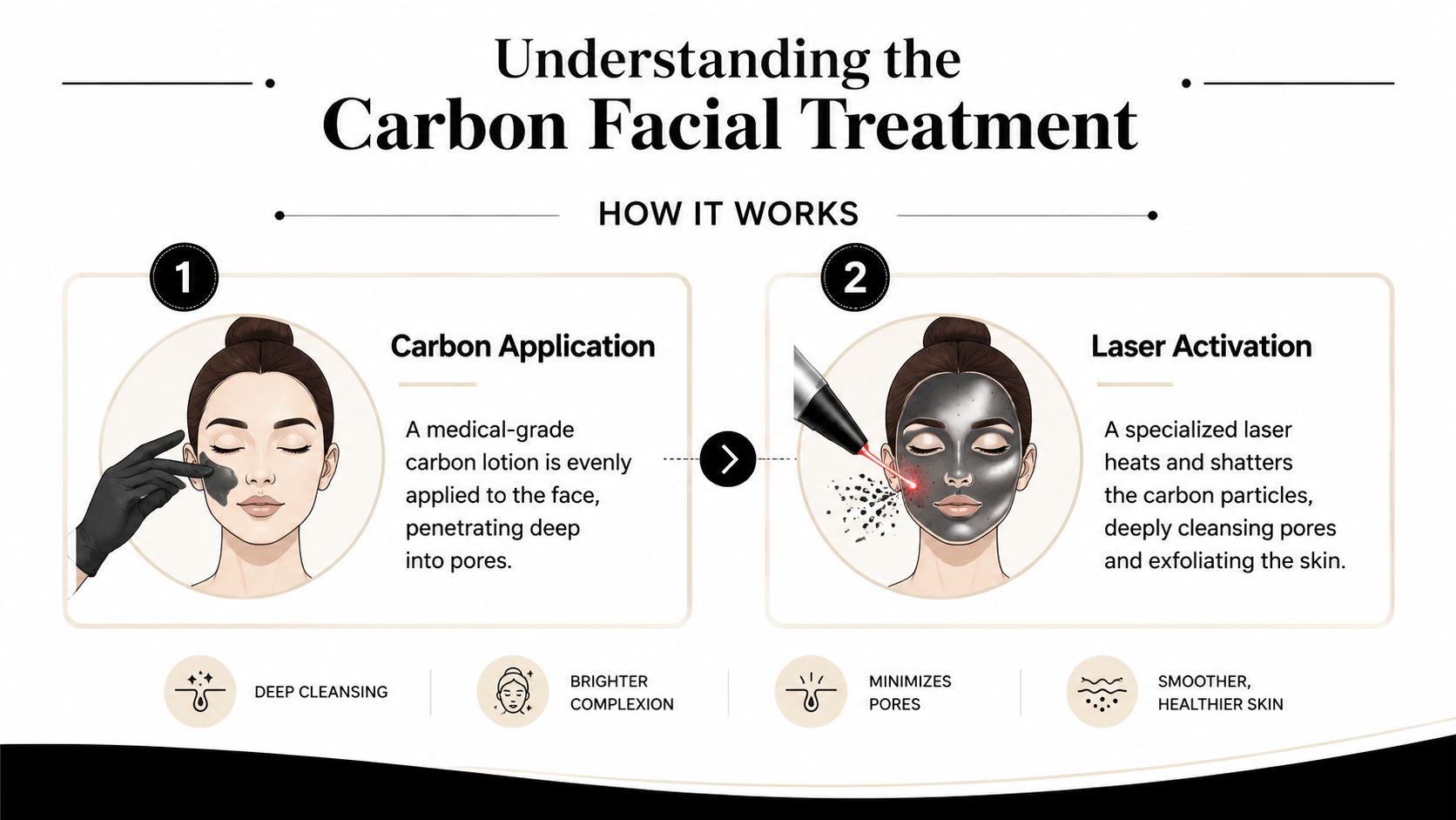 An infographic showing the two-step carbon facial treatment process of carbon application followed by laser activation.