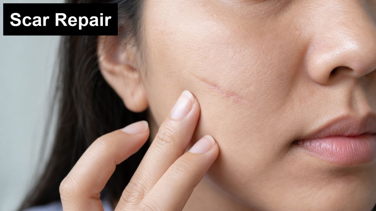 A close-up of a woman touching a noticeable facial scar on her cheek, illustrating skin recovery treatments.