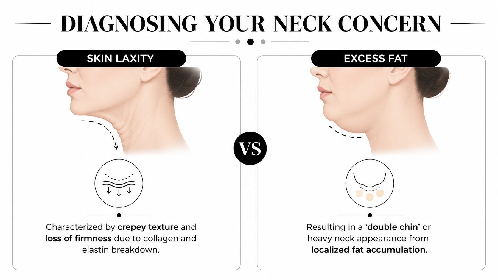 An infographic comparing neck skin laxity and excess fat to help diagnose specific neck skin concerns.
