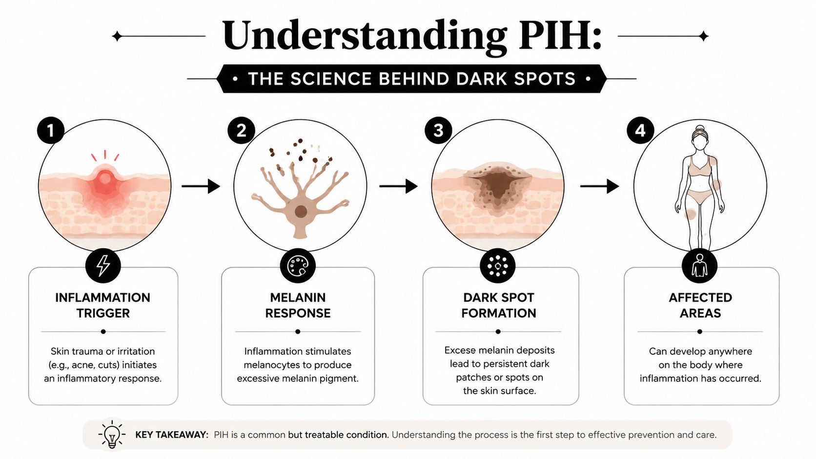 An infographic illustrating the four stages of post-inflammatory hyperpigmentation development, from initial skin inflammation to dark spot formation.