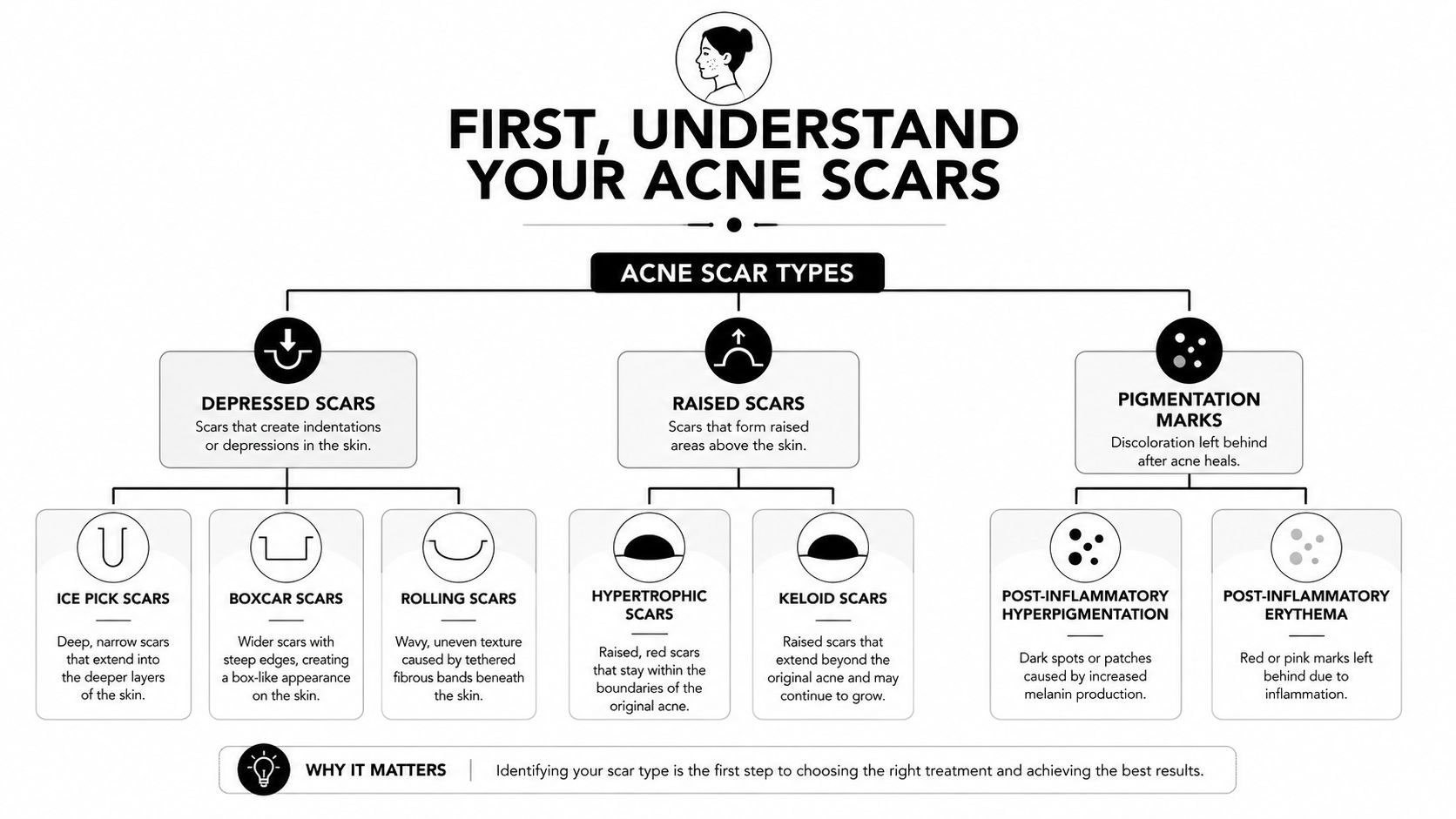 A diagnostic flow chart categorizing different types of acne scars including depressed, raised, and pigmentation marks.