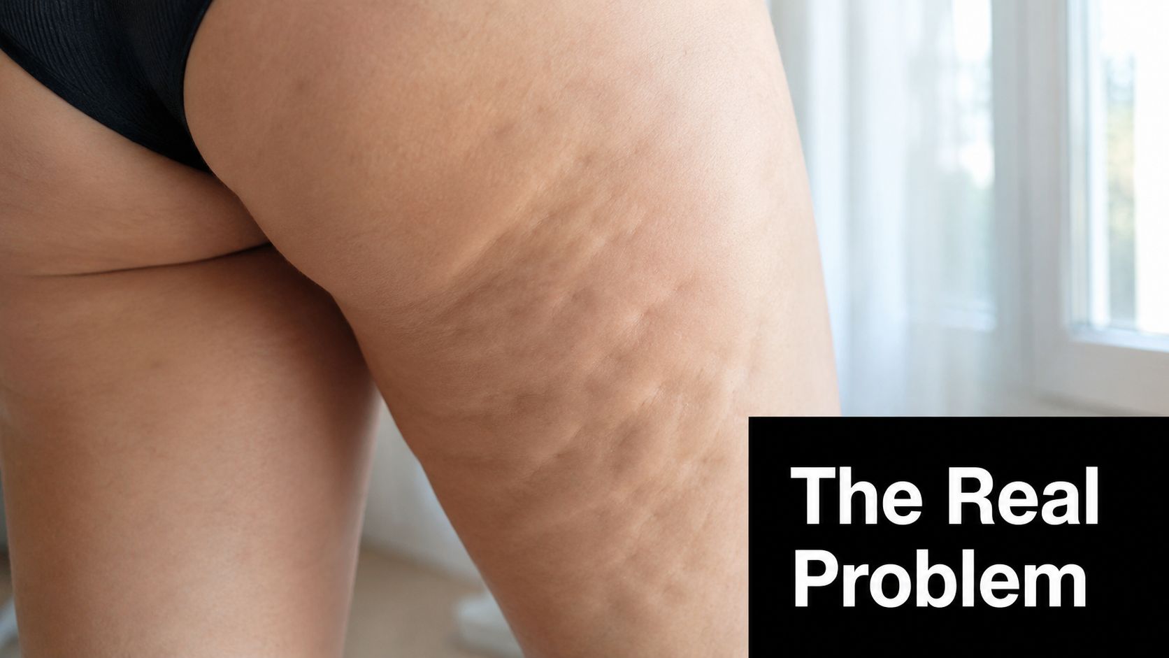 A close-up view of a woman's thigh and buttocks showing the texture of visible cellulite dimpling.