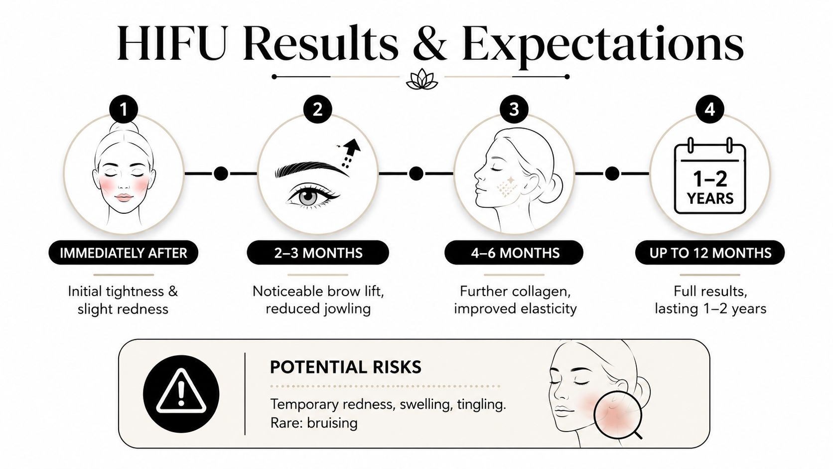 A timeline graphic showing the expected results and timeline for a HIFU ultrasound face lift procedure.