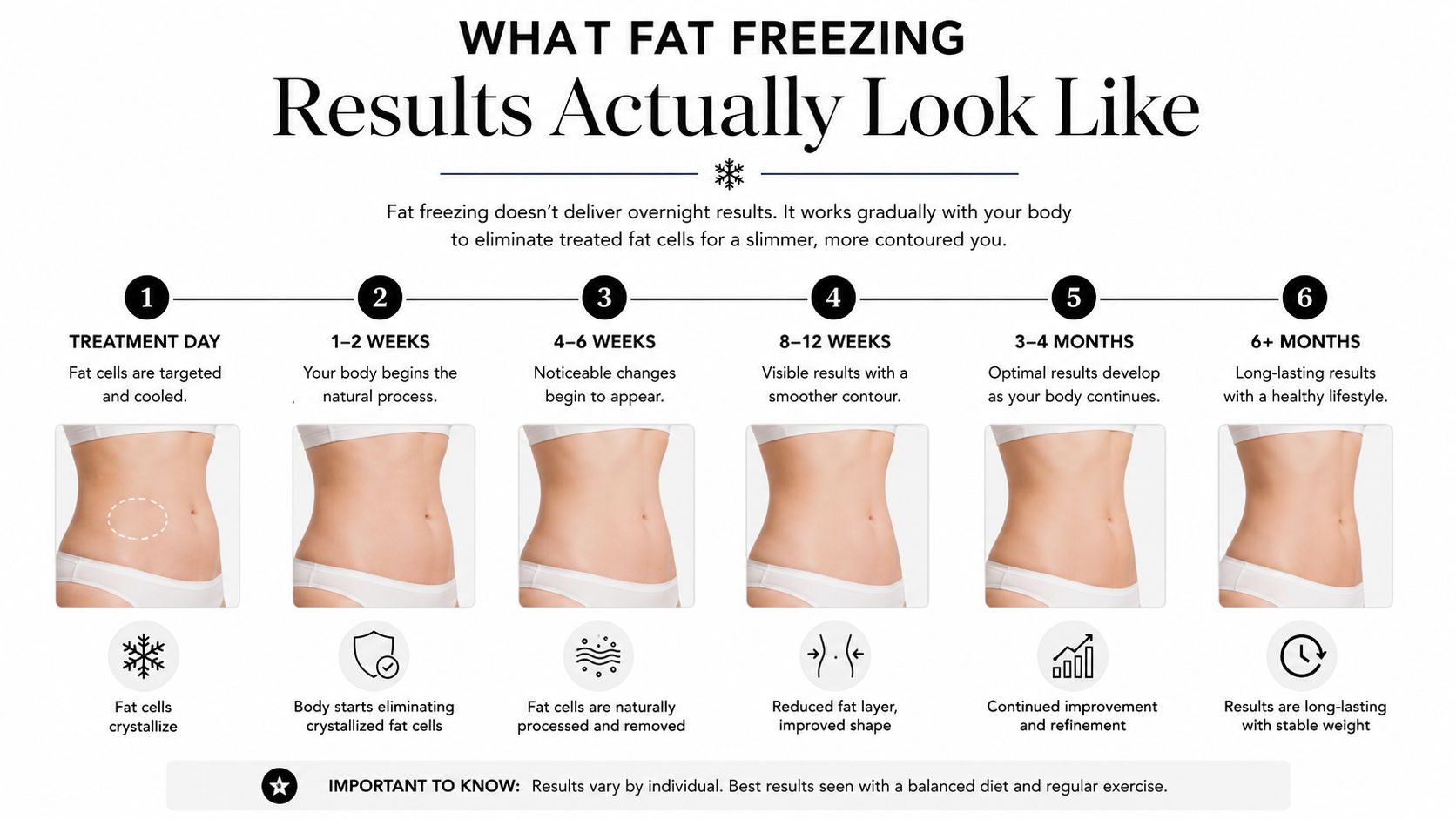 A timeline graphic illustrating the gradual progression of fat freezing results over a six month period.