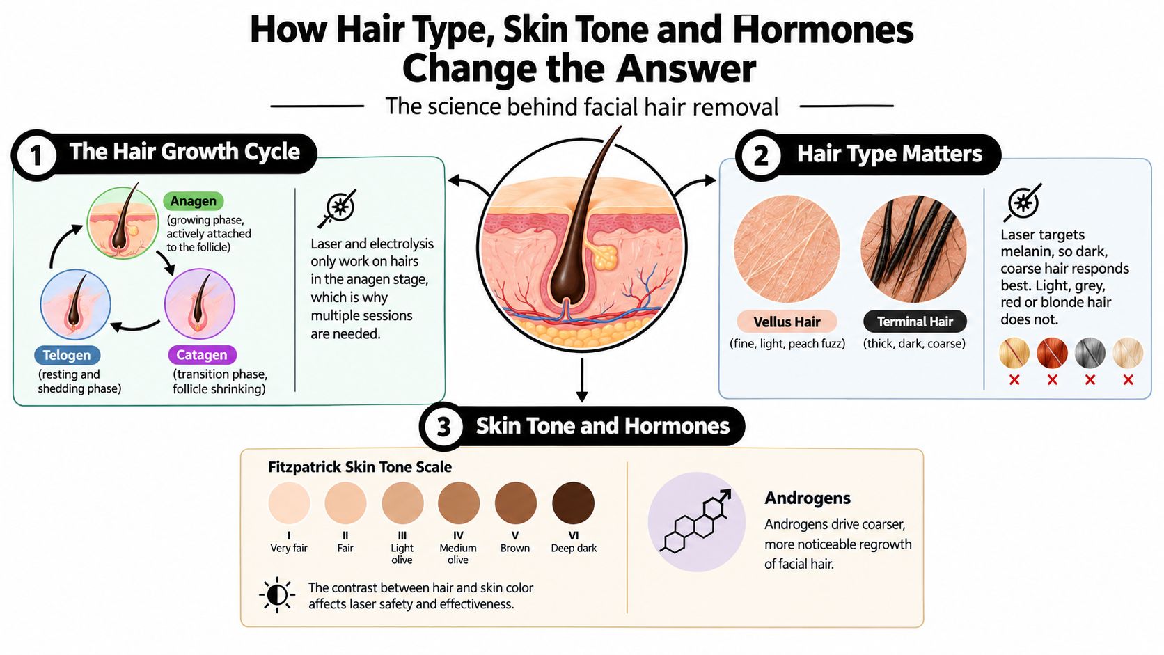 An infographic explaining how hair growth cycles, hair type, skin tone, and hormones affect facial hair removal treatments.