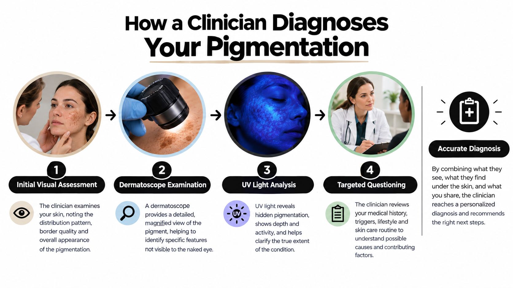 A four-step clinical process showing how a doctor evaluates and diagnoses facial pigmentation skin conditions.