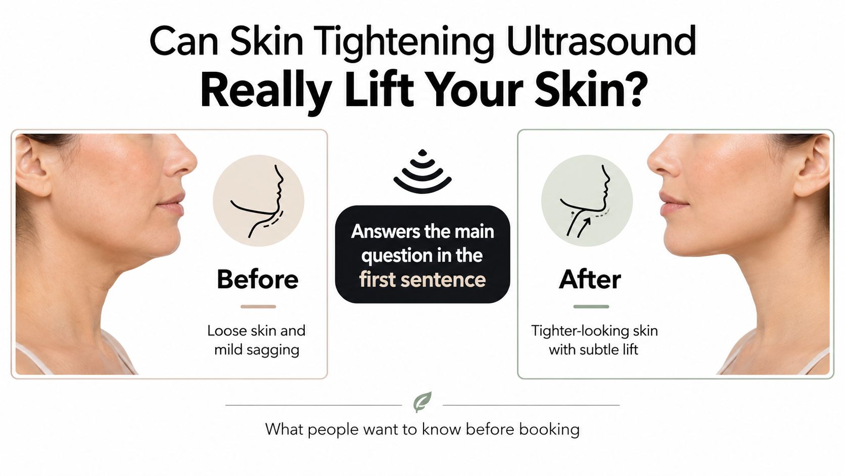 A side-by-side comparison image showing a woman's jawline before and after skin tightening ultrasound treatment.